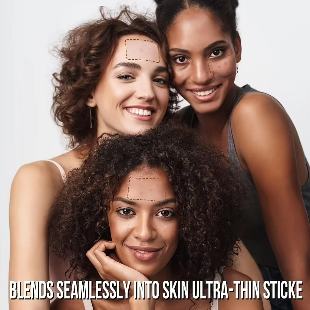 360pcs Face Acne Patch Invisible Skin Care Pimple Acne Patches Anti-inflammatory Healing Absorbing Spot Sticker Covering Acne